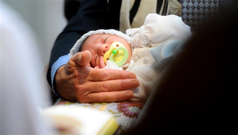 en newborn closes his eyes during his circumcision ceremony. The rate of circumcision in the U.S. has fallen.