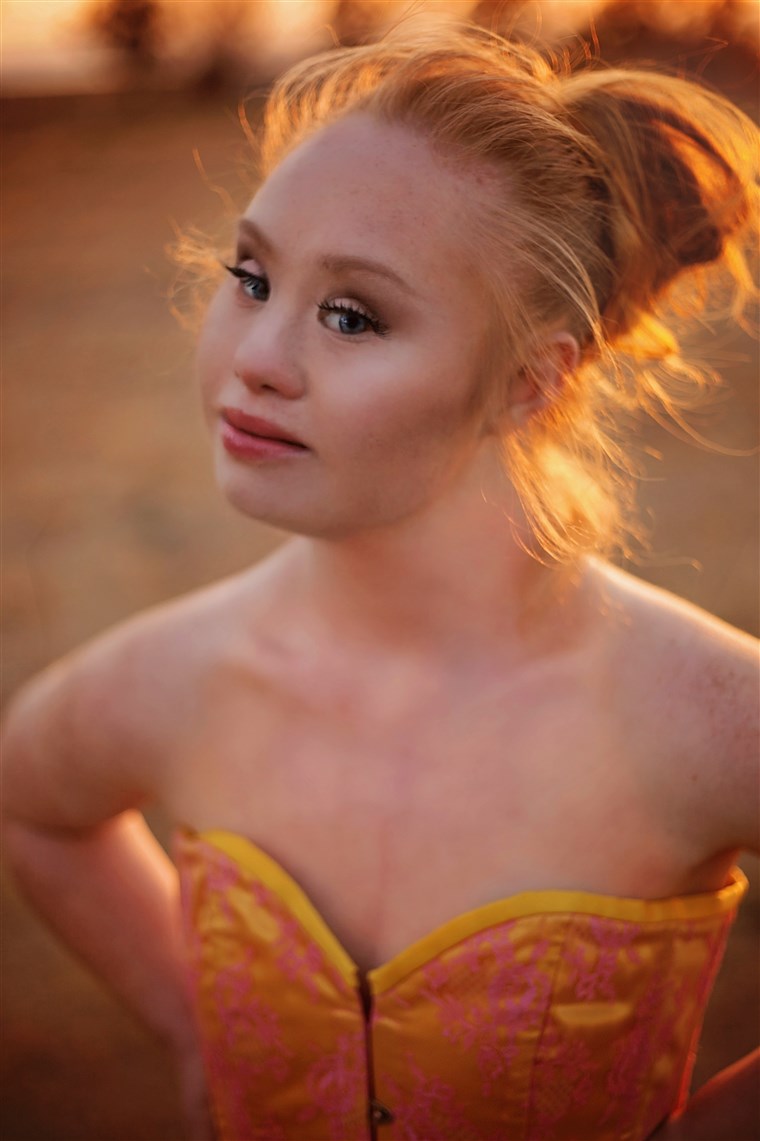 Madeline Stuart, a model with Down syndrome