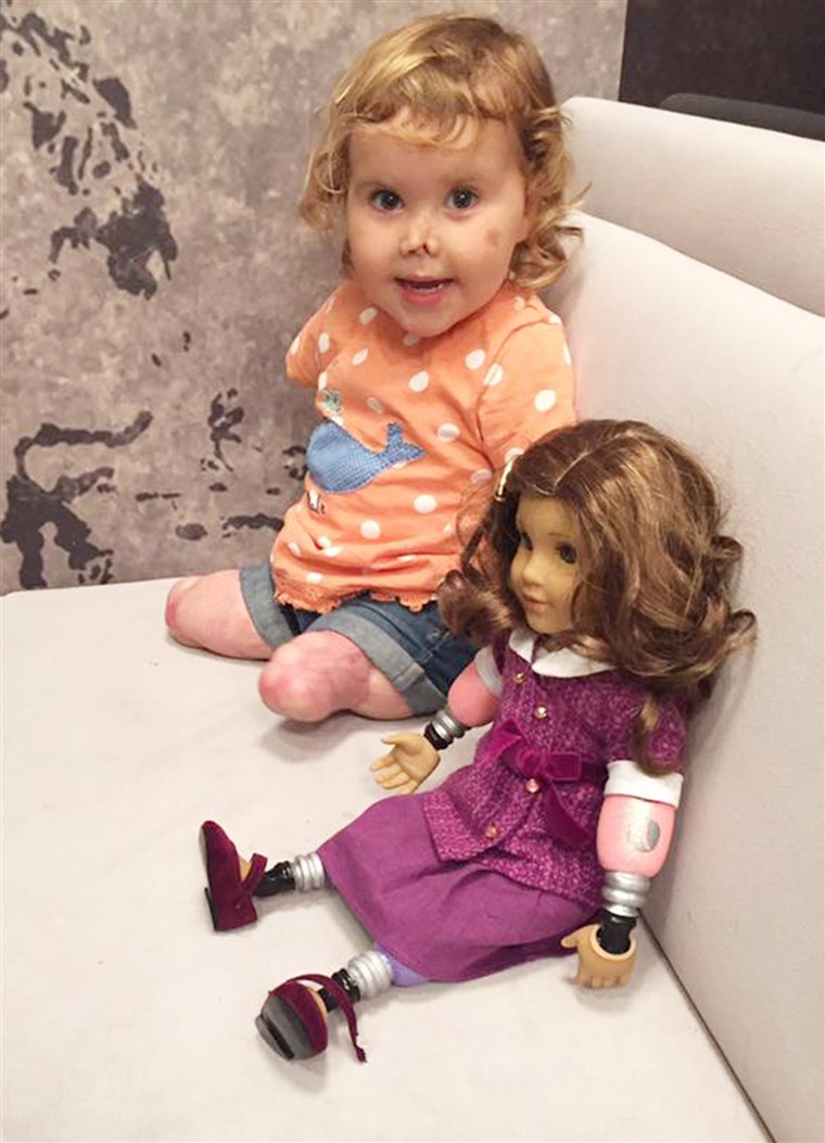 Куадрупле-ампутее toddler receives look-alike doll.