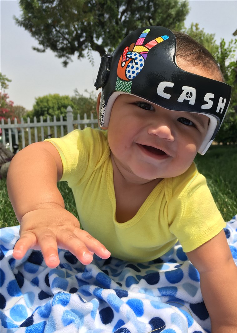 Lauren Katunich's husband, David, is a music producer. So when their son, Cash, needed a corrective helmet, the California couple requested that Strawn create a music-inspired headpiece for their baby. 
