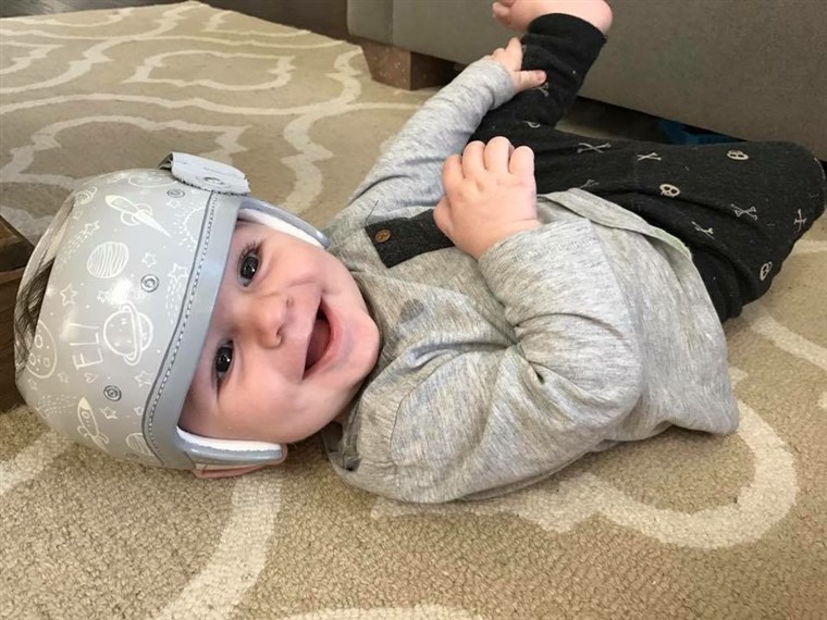 Stephanie Hanrahan says she struggled with seeing a piece of white plastic strapped to her infant son, Eli's, head. So the Texas mom contacted Strawn for some design help. 