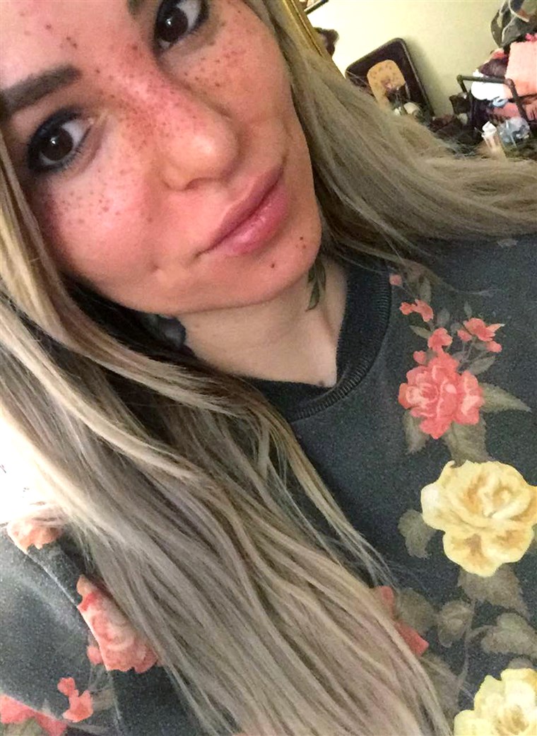 Tatuiruotė artist Sydney Dyer shows off her newly applied freckle tattoos.